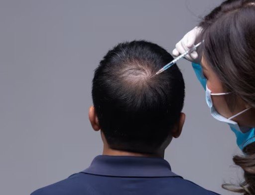 Best Prevent Hair Loss Treatment in Chirag Delhi